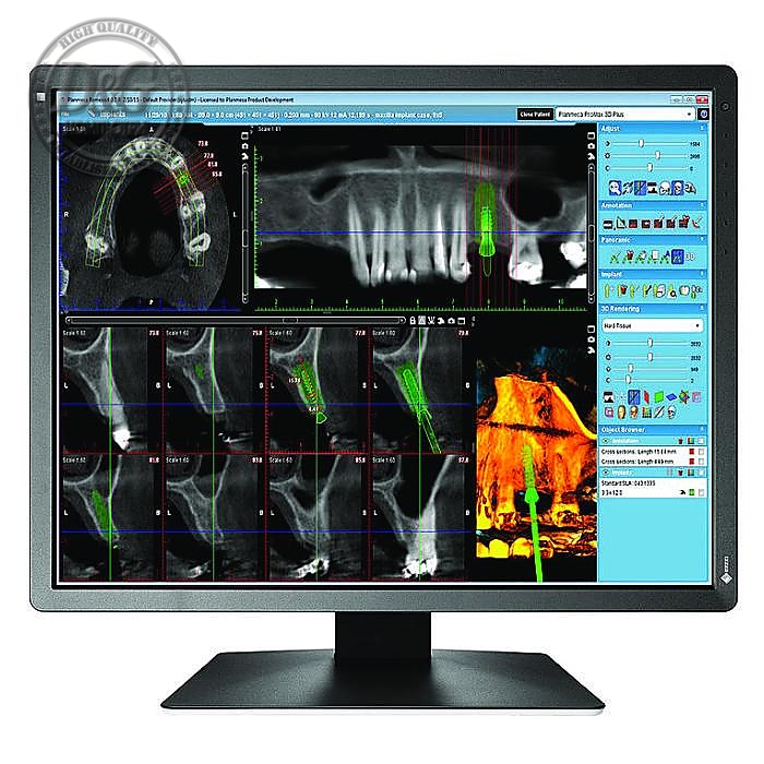 Мµди†ински мони‚ор EIZO RadiForce MX216-SB 2MP ¦вµ‚µн